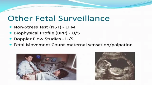 fetal surveillance a practical guide