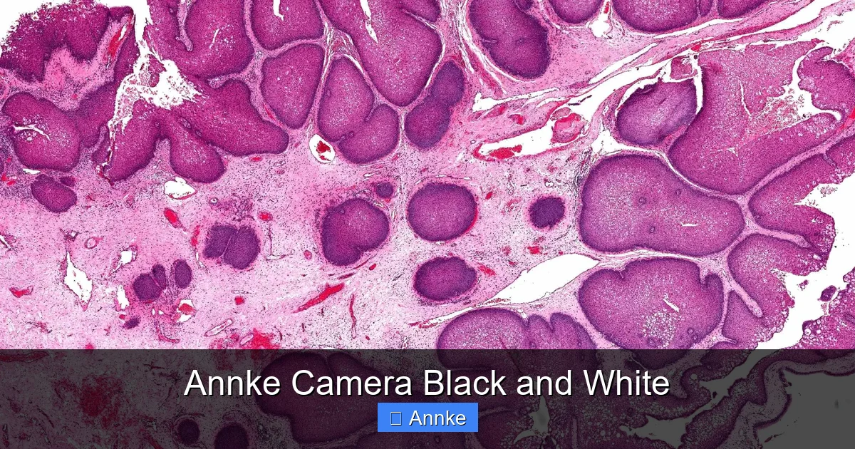 Annke Camera Black and White