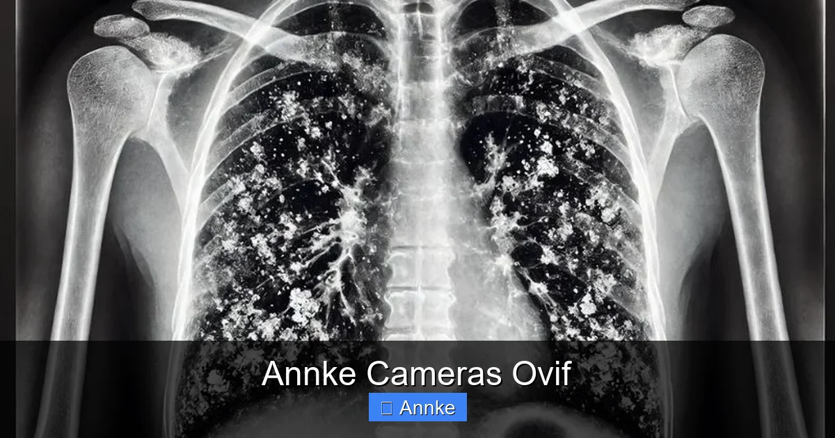 Annke Cameras Ovif