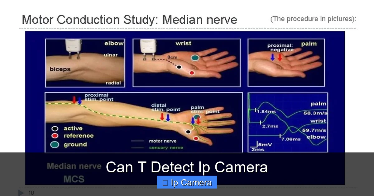 Can T Detect Ip Camera