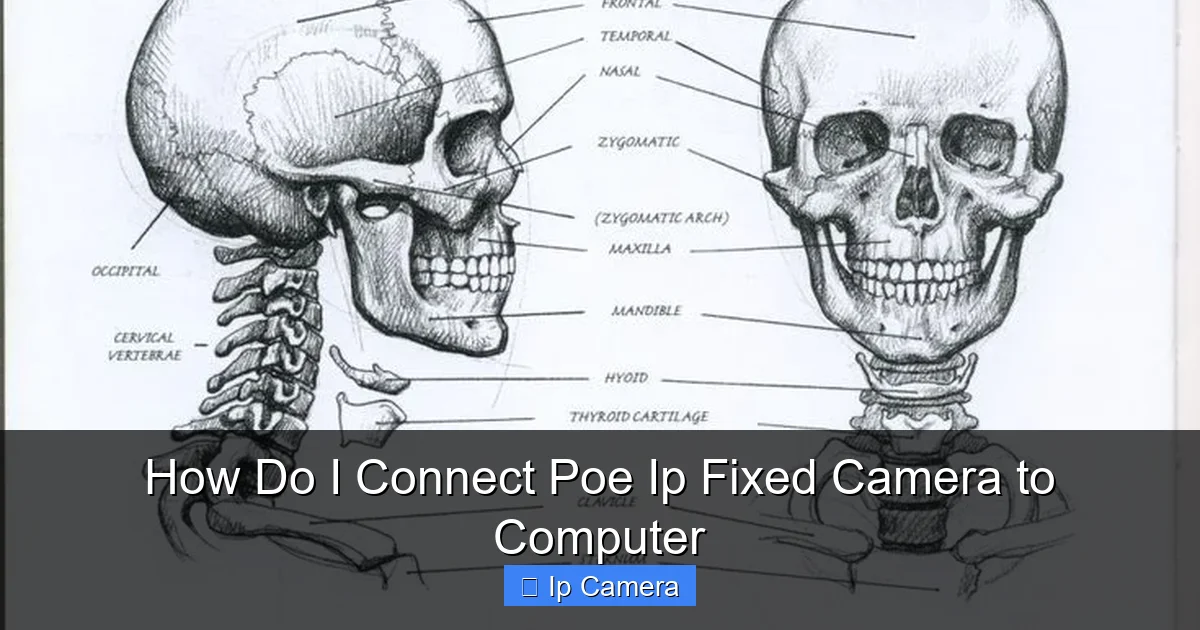 How Do I Connect Poe Ip Fixed Camera to Computer