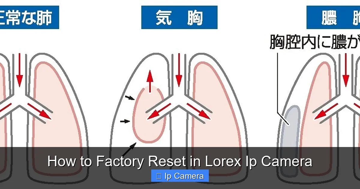 How to Factory Reset in Lorex Ip Camera