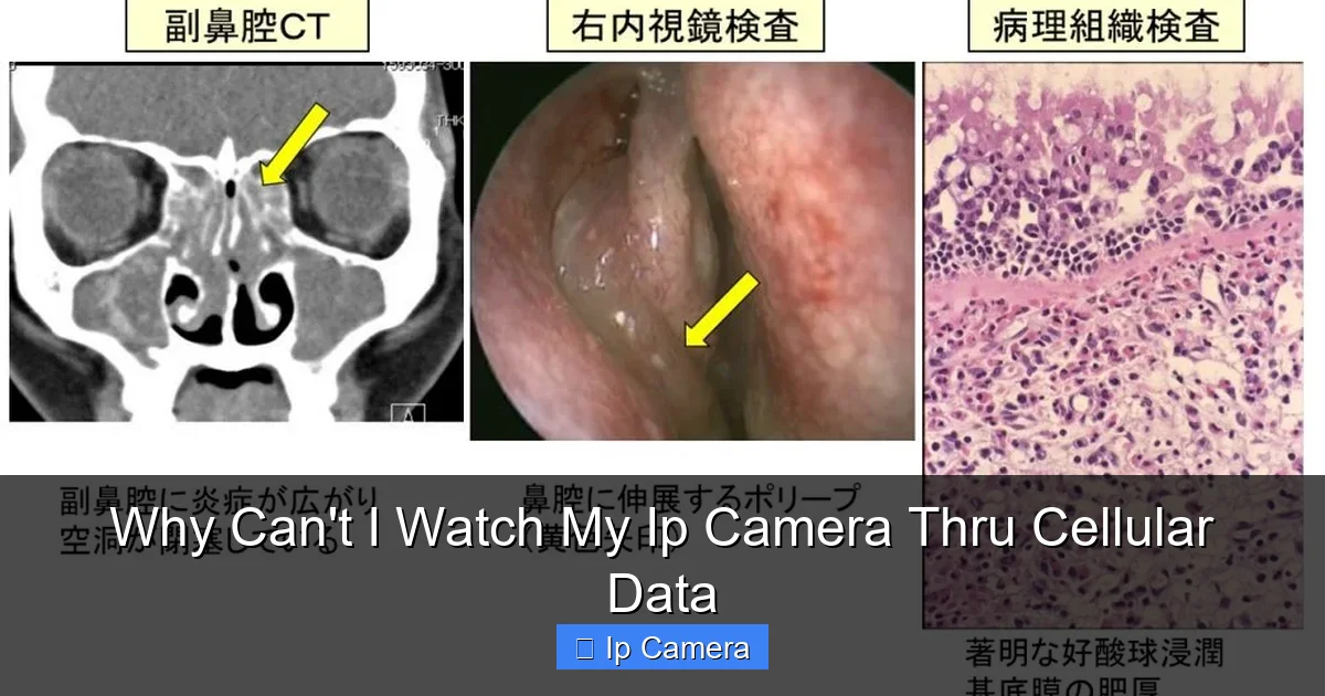 Why Can't I Watch My Ip Camera Thru Cellular Data