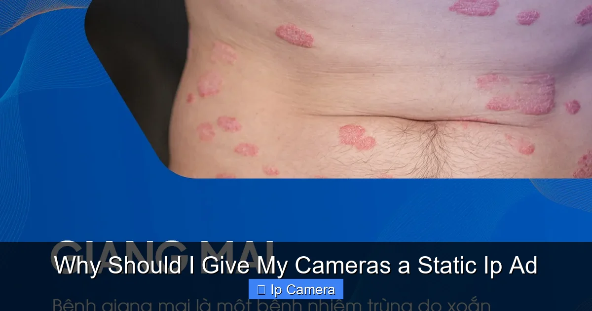 Why Should I Give My Cameras a Static Ip Ad