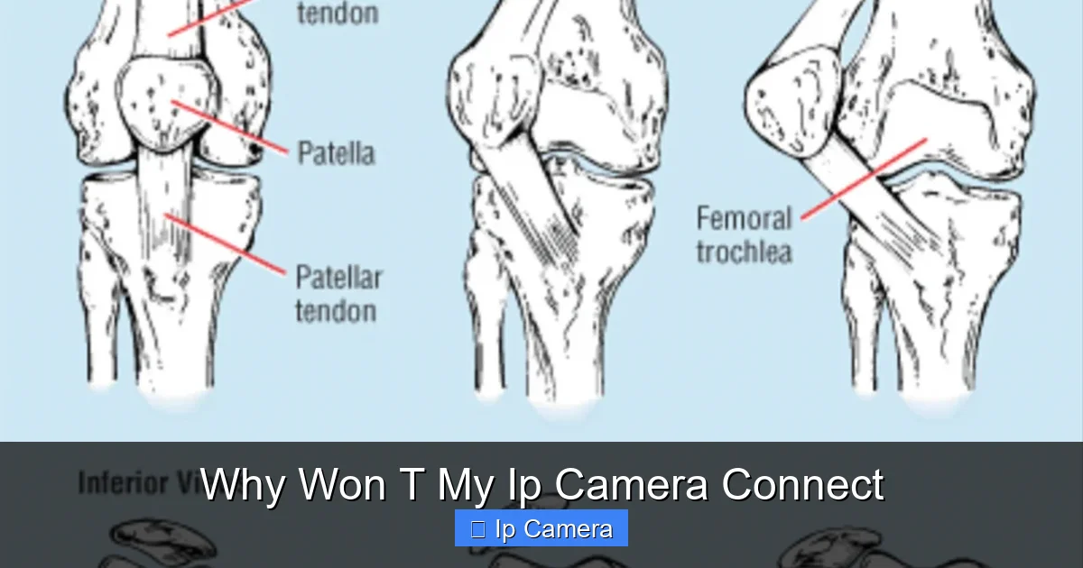 Why Won T My Ip Camera Connect